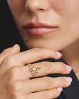 Ring star with zirconia